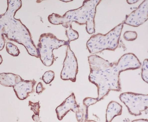 Anti-Growth Hormone GH1 Rabbit Monoclonal Antibody Boster Bio