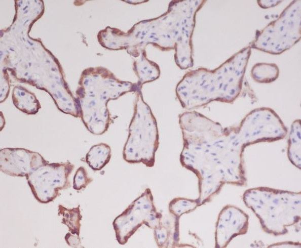 Anti-Growth Hormone GH1 Rabbit Monoclonal Antibody Boster Bio