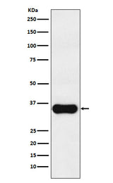 Anti-MC1 Receptor Rabbit Monoclonal Antibody Boster Bio