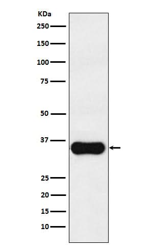 Anti-MC1 Receptor Rabbit Monoclonal Antibody Boster Bio