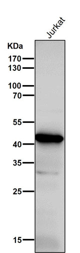 Anti-ADA Rabbit Monoclonal Antibody Boster Bio