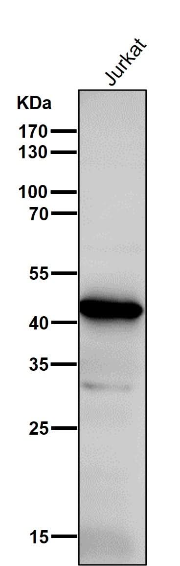 Anti-ADA Rabbit Monoclonal Antibody Boster Bio