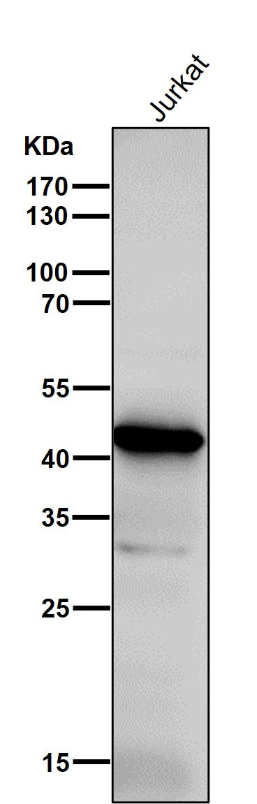 Anti-ADA Rabbit Monoclonal Antibody Boster Bio