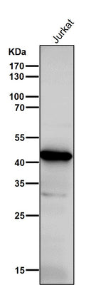 Anti-ADA Rabbit Monoclonal Antibody Boster Bio