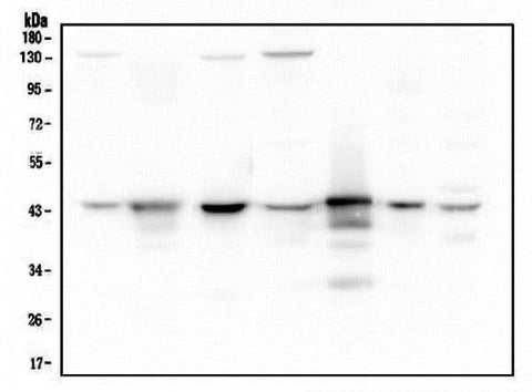 Anti-ADA Antibody Picoband® (monoclonal, 6D4 Boster Bio