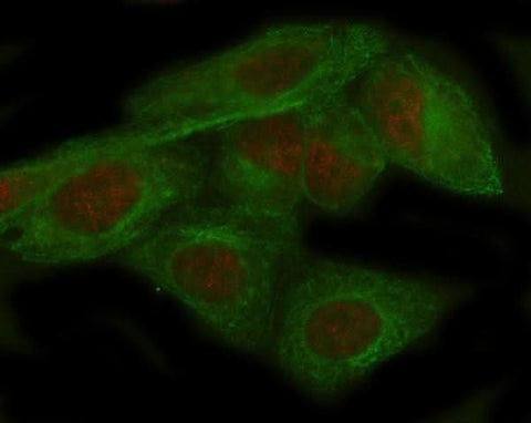 Anti-ADAR1 Monoclonal Antibody Boster Bio