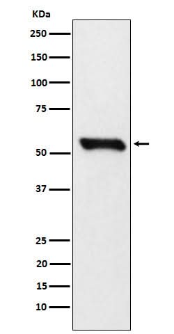 Anti-DLDH Rabbit Monoclonal Antibody Boster Bio