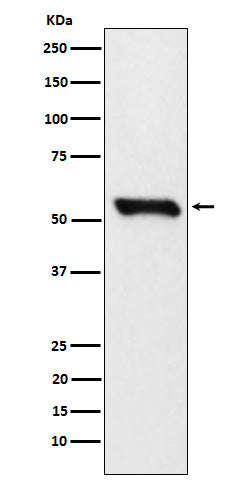 Anti-DLDH Rabbit Monoclonal Antibody Boster Bio