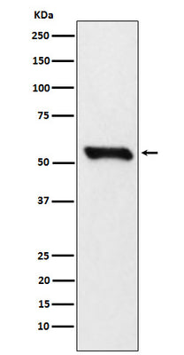 Anti-DLDH Rabbit Monoclonal Antibody Boster Bio