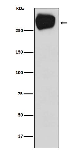 Anti-MRP1 ABCC1 Rabbit Monoclonal Antibody Boster Bio