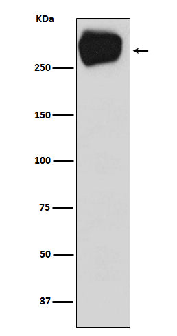 Anti-MRP1 ABCC1 Rabbit Monoclonal Antibody Boster Bio