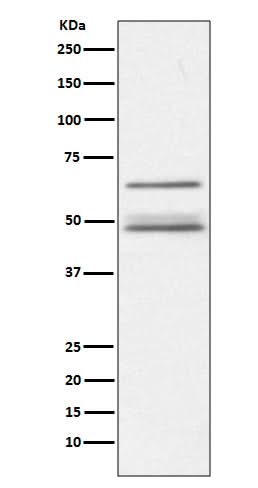 Anti-IKK gamma IKBKG Rabbit Monoclonal Antibody Boster Bio