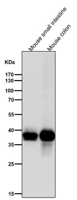 Anti-CDX2 Rabbit Monoclonal Antibody Boster Bio