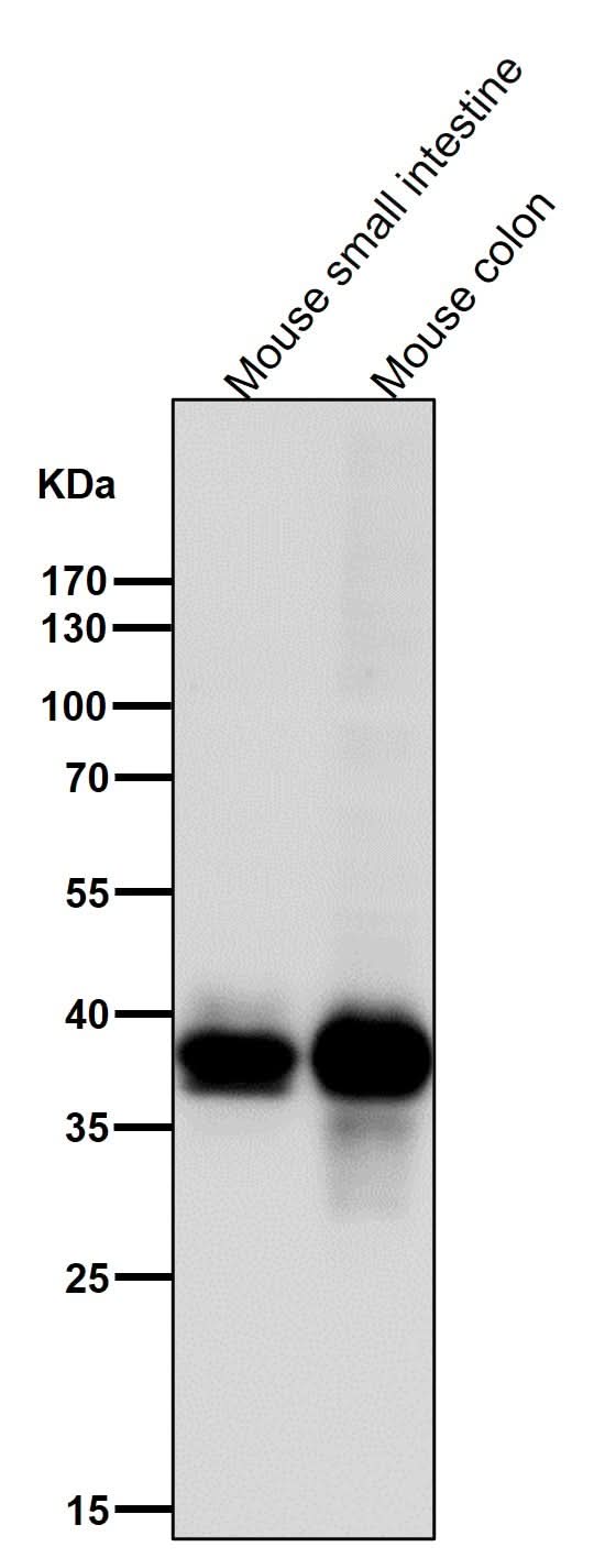 Anti-CDX2 Rabbit Monoclonal Antibody Boster Bio