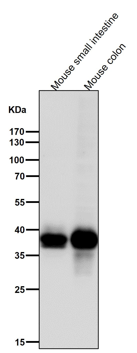 Anti-CDX2 Rabbit Monoclonal Antibody Boster Bio