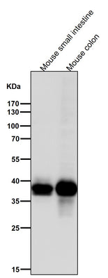 Anti-CDX2 Rabbit Monoclonal Antibody Boster Bio