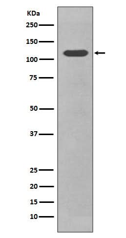 Anti-CD34 Rabbit Monoclonal Antibody Boster Bio