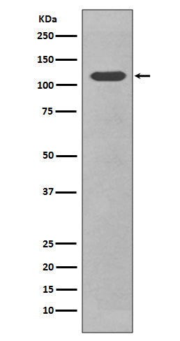 Anti-CD34 Rabbit Monoclonal Antibody Boster Bio