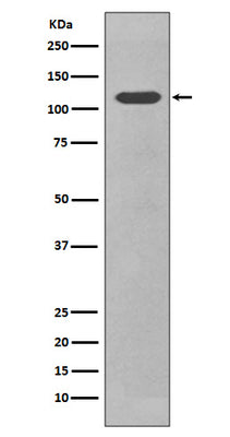 Anti-CD34 Rabbit Monoclonal Antibody Boster Bio