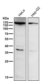 Anti-APAF1 Rabbit Monoclonal Antibody Boster Bio