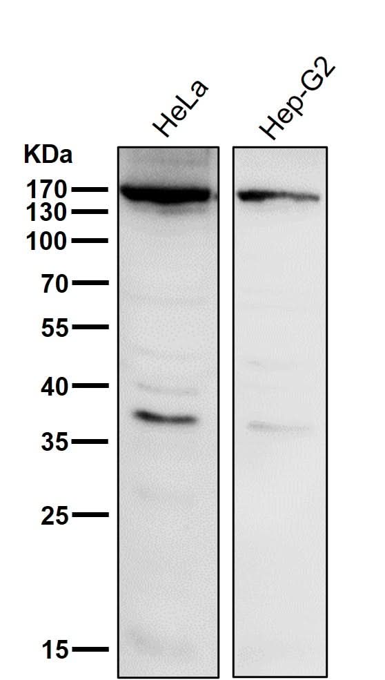 Anti-APAF1 Rabbit Monoclonal Antibody Boster Bio