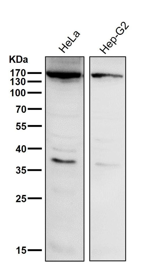 Anti-APAF1 Rabbit Monoclonal Antibody Boster Bio