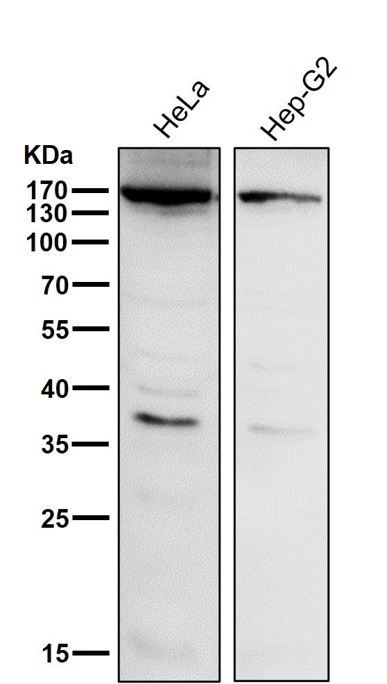 Anti-APAF1 Rabbit Monoclonal Antibody Boster Bio