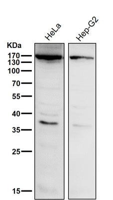 Anti-APAF1 Rabbit Monoclonal Antibody Boster Bio
