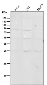 Anti-PMP22 Monoclonal Antibody Boster Bio