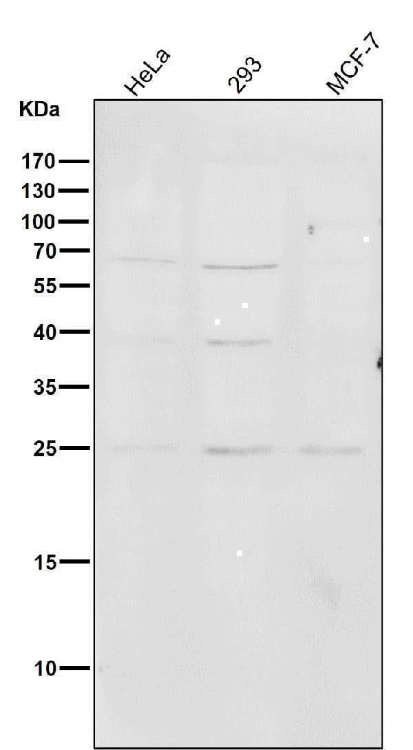 Anti-PMP22 Monoclonal Antibody Boster Bio