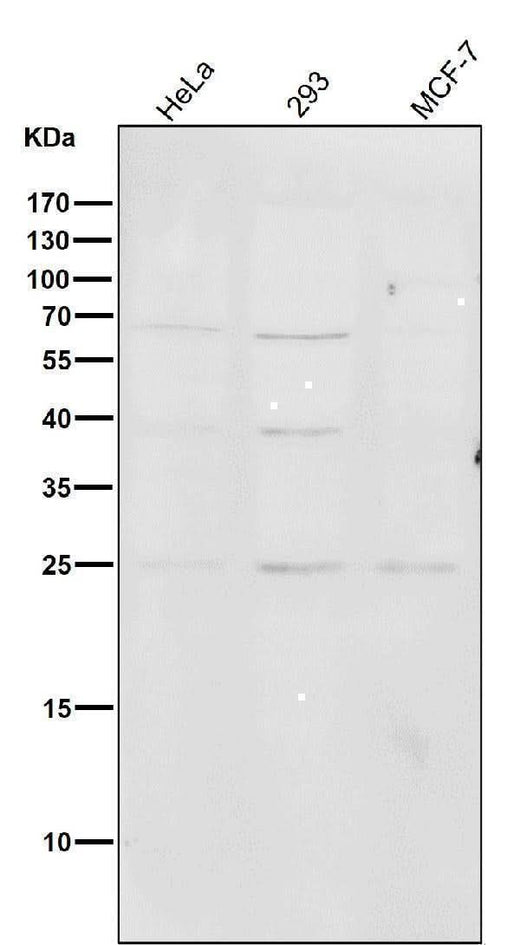 Anti-PMP22 Monoclonal Antibody Boster Bio