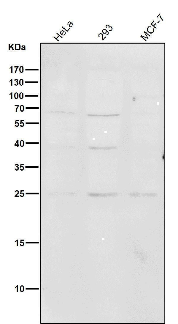 Anti-PMP22 Monoclonal Antibody Boster Bio