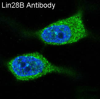 Anti-Lin28B Rabbit Monoclonal Antibody Boster Bio