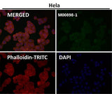 Anti-GNAQ Rabbit Monoclonal Antibody Boster Bio