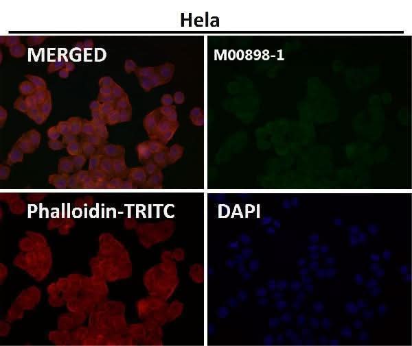 Anti-GNAQ Rabbit Monoclonal Antibody Boster Bio