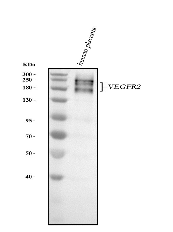 Anti-VEGF Receptor 2 KDR Rabbit Monoclonal Antibody Boster Bio