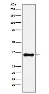 Anti-HOXA9 Rabbit Monoclonal Antibody Boster Bio