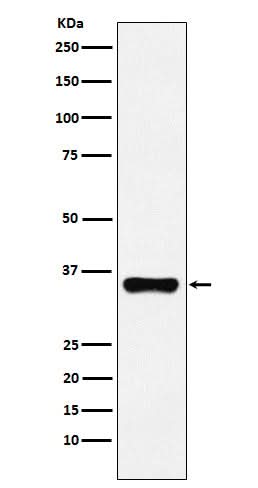 Anti-HOXA9 Rabbit Monoclonal Antibody Boster Bio