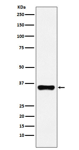 Anti-HOXA9 Rabbit Monoclonal Antibody Boster Bio