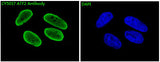Anti-ATF2 Rabbit Monoclonal Antibody Boster Bio