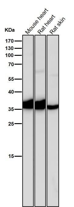 Anti-IGFBP1 Rabbit Monoclonal Antibody Boster Bio