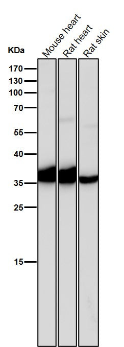 Anti-IGFBP1 Rabbit Monoclonal Antibody Boster Bio
