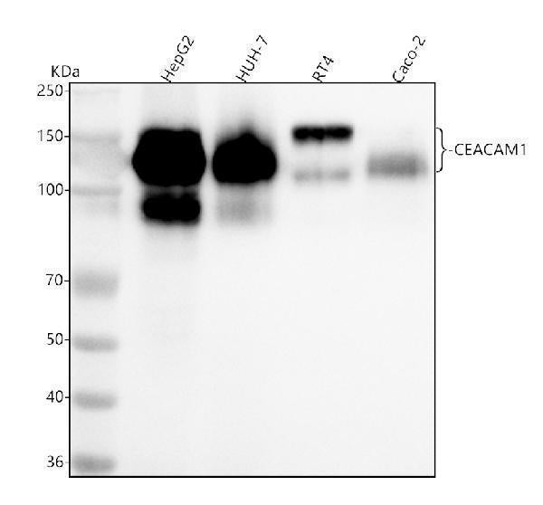 Anti-CEACAM1 Rabbit Monoclonal Antibody Boster Bio