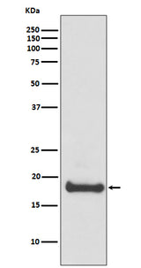 Anti-ARF6 Rabbit Monoclonal Antibody Boster Bio