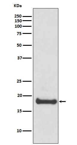 Anti-ARF6 Rabbit Monoclonal Antibody Boster Bio