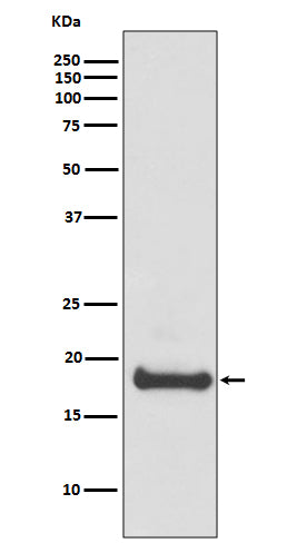 Anti-ARF6 Rabbit Monoclonal Antibody Boster Bio