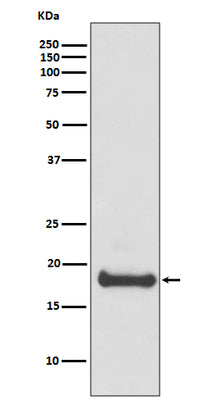 Anti-ARF6 Rabbit Monoclonal Antibody Boster Bio