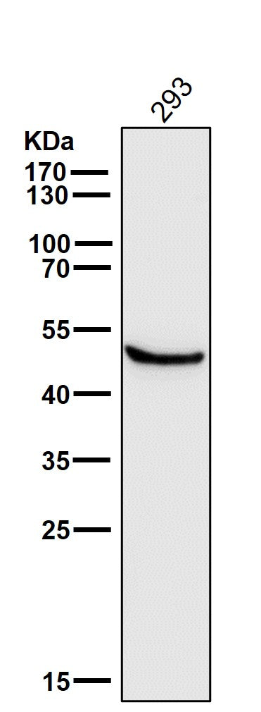 Anti-Glutathione Synthetase Rabbit Monoclonal Antibody Boster Bio