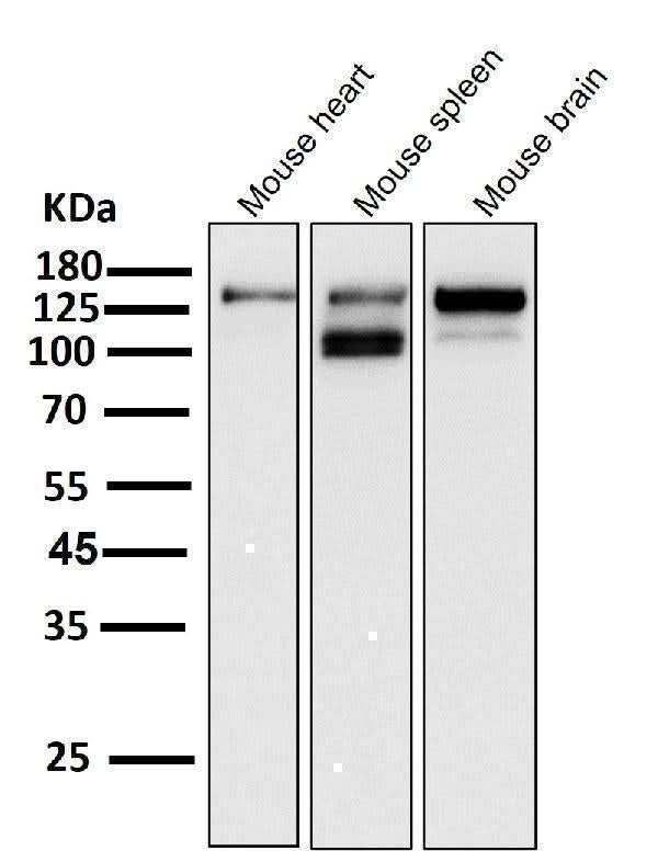 Anti-ASK1 MAP3K5 Rabbit Monoclonal Antibody Boster Bio