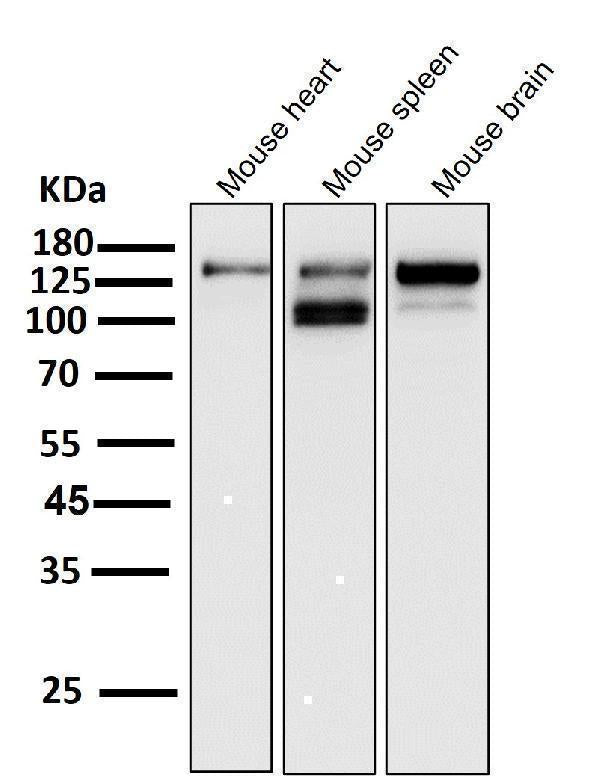 Anti-ASK1 MAP3K5 Rabbit Monoclonal Antibody Boster Bio